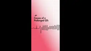 Causes of QT Interval Prolongation