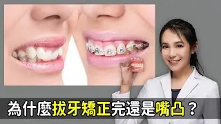 拔牙矯正完嘴還凸？牙套戴很久？恐是深咬惹的禍｜林榆芩醫師