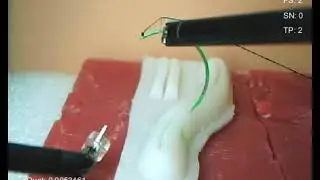 Autonomous Continuous Suturing Using Dual-Arm Surgical Robot