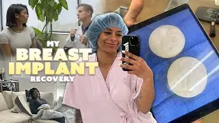 My Breast Implant Recovery And What I Did To Heal Faster