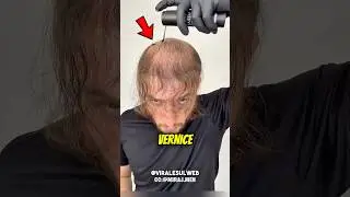 He wanted to HIDE his BALDNESS, but…😅 