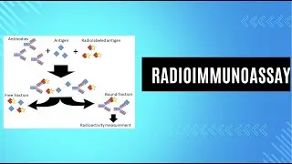 Radioimmunoassay | Radiotherapy Edutech | General Topics
