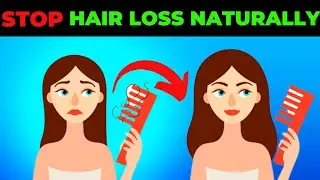 THIS IS HOW YOU CAN STOP HAIR LOSS NATURALLY | The BEST HAIR LOSS CURES AT THE MOMENT