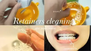 [After Braces] How to Clean Your Retainers 🪥🫧