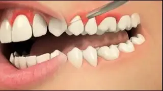 Лечение зубов и десен