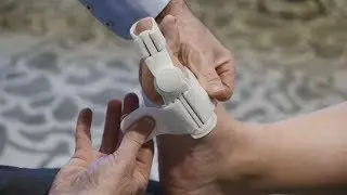 The Benefits of Using an Aircast Hallufix Bunion Aid Splint - Waikato Podiatry Clinic