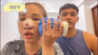 RHINOPLASTY EXPERIENCE | MASAKIT BA? 😢 | Martinavlogs