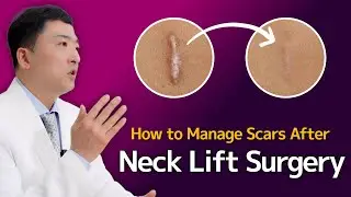Scars After Neck Lift Surgery Can Last Forever Without Proper Care!