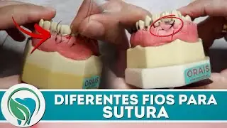 Podemos utilizar qualquer tipo de fio para realizar uma sutura?