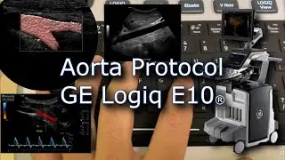 Aorta Protocol Logiq E10