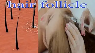 Hair follicle| follicale hair damage  just information { PART 1 }