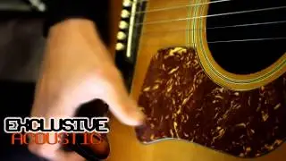 Eyez Ft Sam Moore & SK - Too Long [Exclusive Acoustic]