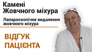 Камни в желчном пузыре операция (лапароскопия) - отзыв пациента клиники