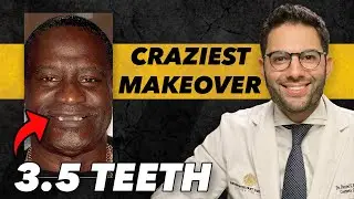 How I Fixed a Smile With only 3 and a Half Teeth | Dr Daniel
