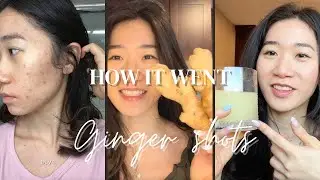 30 days of ginger shots for my acne prone skin
