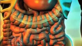 Food Poisoning Medical Course