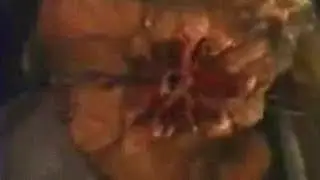 It Itches, It Burns, It Kills