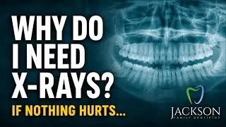 Why Do I Need X-Rays If Nothing Hurts? | Dentist Explains
