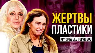 ЖЕРТВЫ ПЛАСТИКИ: В ПОГОНЕ ЗА КРАСОТОЙ ПОТЕРЯЛИ СЕБЯ