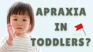Early Signs of Childhood Apraxia of Speech (CAS) in Toddlers | Don't Miss these Red Flags
