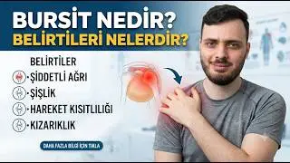 Bursit Nedir? Belirtileri Nelerdir?