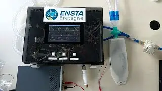 High flow oxygenation and ventilator prototype