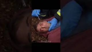 У него выпали глаза из глазниц