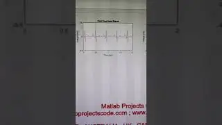 Fetal ECG Extraction Simulink model   FECG   Fetal ECG   ECG  MATLAB SIMULINK