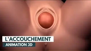 Comment se passe un accouchement? | Un docteur explique.