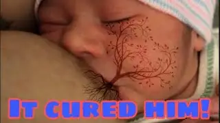 Breastmilk Cured My Sons Jaundice | Breastfeeding Q&A | Teen Mom
