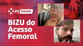 Bizu do Acesso Femoral