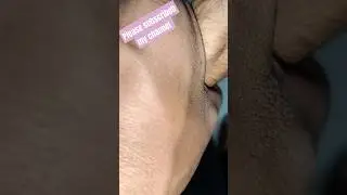 pharma.. motivated.. video.. part 379 