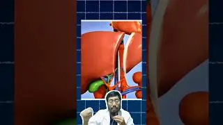 PROSES DOKTER POTONG LIVER untuk dibagi bagi, begini prosesnya 