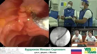 31. ЭРХПГ-стентирование.  М. С. Бурдюков, Д. В.  Гусев