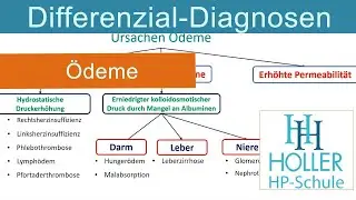 Differential Diagnosis of Edema: Pass the Alternative Practitioner Exam with Holler Training Videos