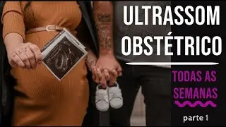 Ultrassom todas as semanas da gestação (vídeo)