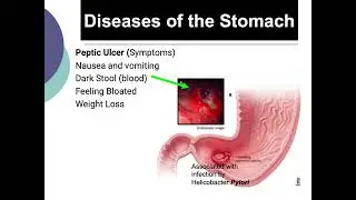 Lesson 1 Anatomy and Physiology of the Digestive System v2