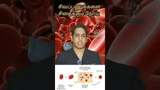 சிவப்பணுக்களை சிதைக்கும் நோய்|Autoimmune Hemolytic anaemia|Hemolysis #anaemia #hemolysis #autoimmune