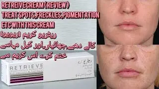Retrieve cream review | Retin A Cream | Tretinoin Cream | Remove wrinkle,Spots etc with this cream