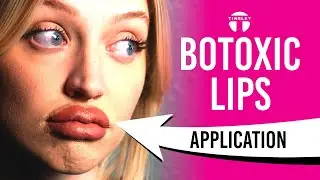 Botox Lips without ANY Botox?!