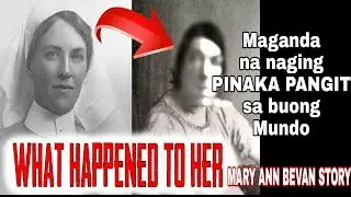 Maganda na Naging Pinaka Pangit sa Buong Mundo | Mary Ann Bevan Story