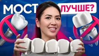 НЕ ставьте мостовидный протез, пока не посмотрите это ВИДЕО!