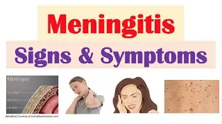 Meningitis Signs and Symptoms (& Why They Occur)