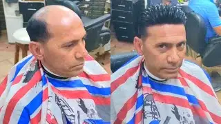 الشبكية الفرنسية في مصر شبكية الجزور الطبيعي الاصلية