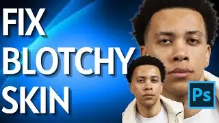 How to Fix Blotchy Skin in Photoshop