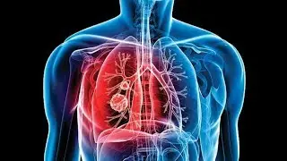 Tuberculosis Testing *TB*