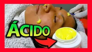 CURSO de PEELING  🔥 Acido retinoico EL MEJOR?  ✅🏆 DEMOSTRACIÓN