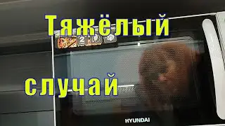 ТЯЖЕЛЫЙ СЛУЧАЙ/ ЖИВУ НА ДВЕ СЕМЬИ  /20 сентября 2023
