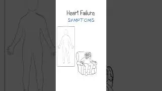 Heart failure symptoms EXPLAINED 