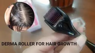 How To Use Derma Roller For Hair Regrowth At Home| Where To Buy it, Price and Benefits|